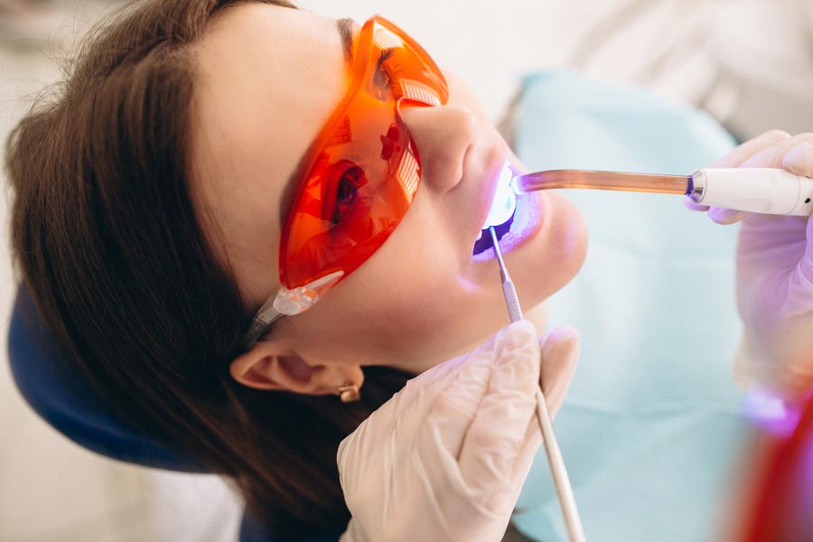 clareamento-dental