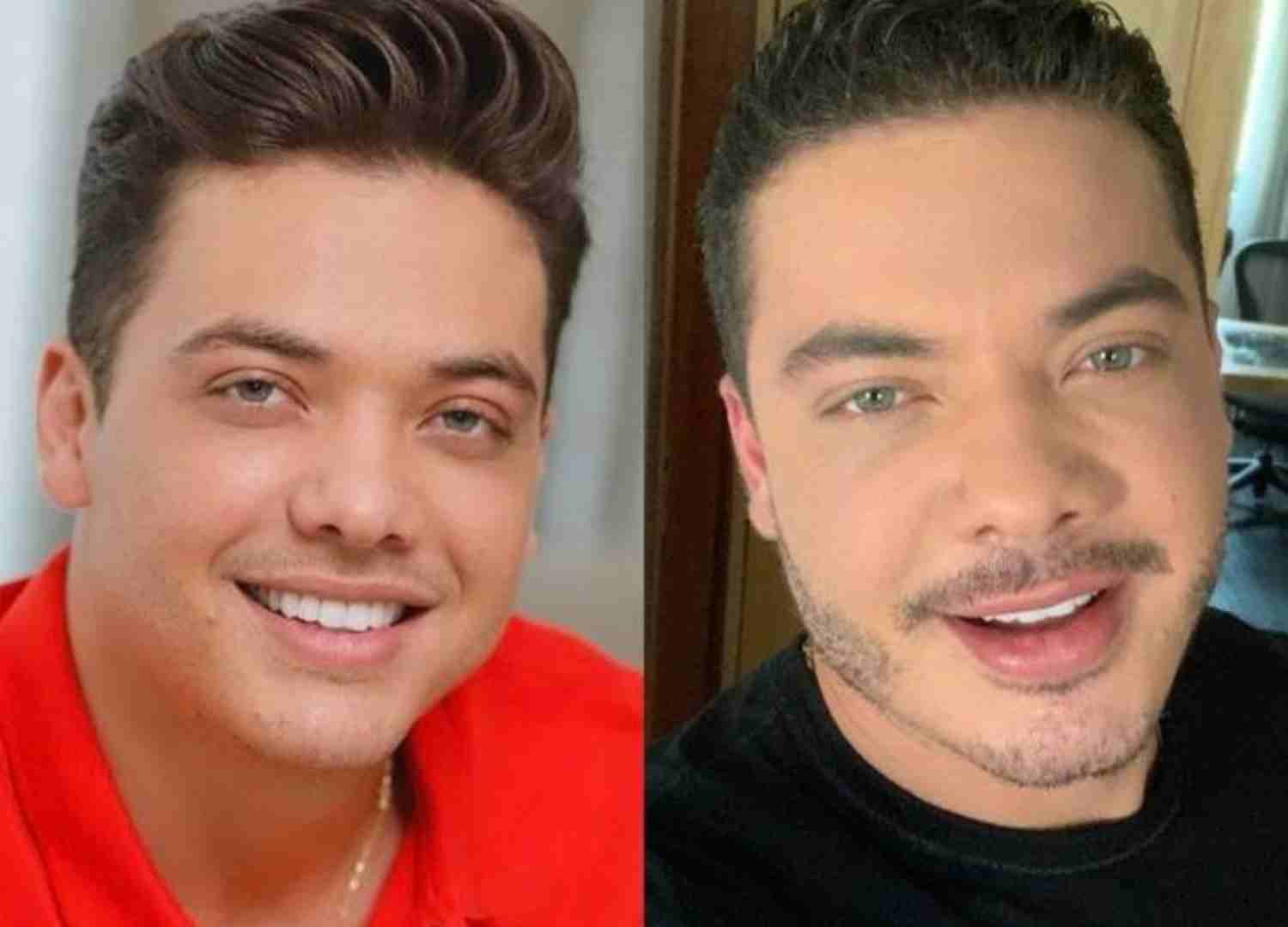 harmonizacao famosos (4)