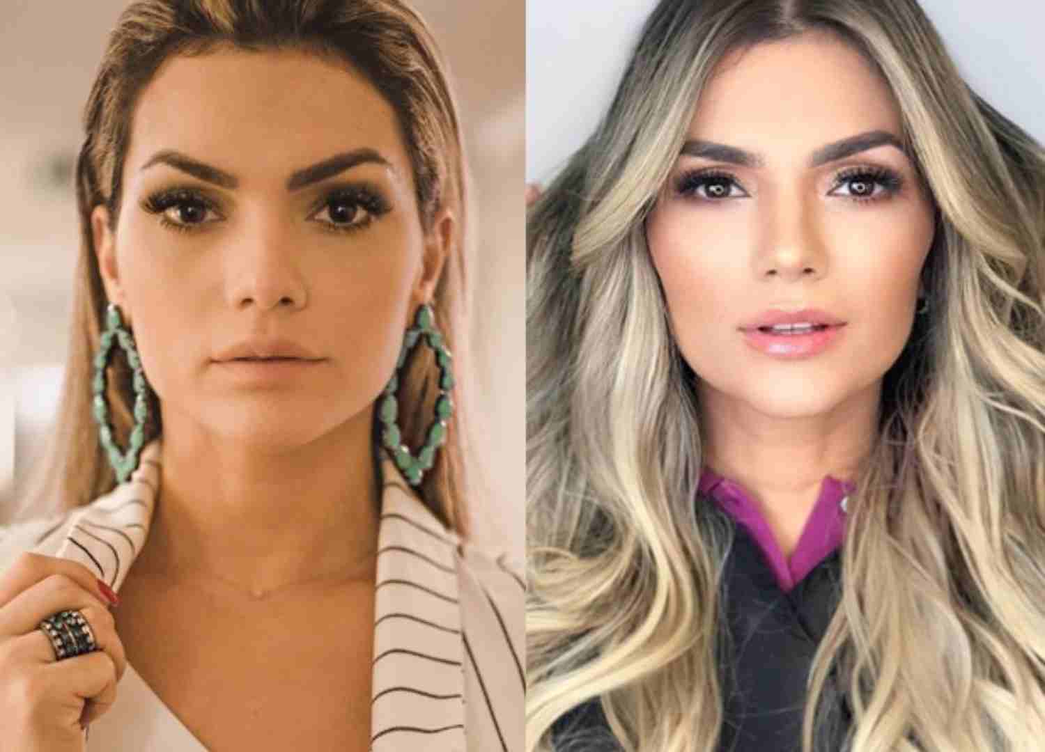 harmonizacao famosos (6)