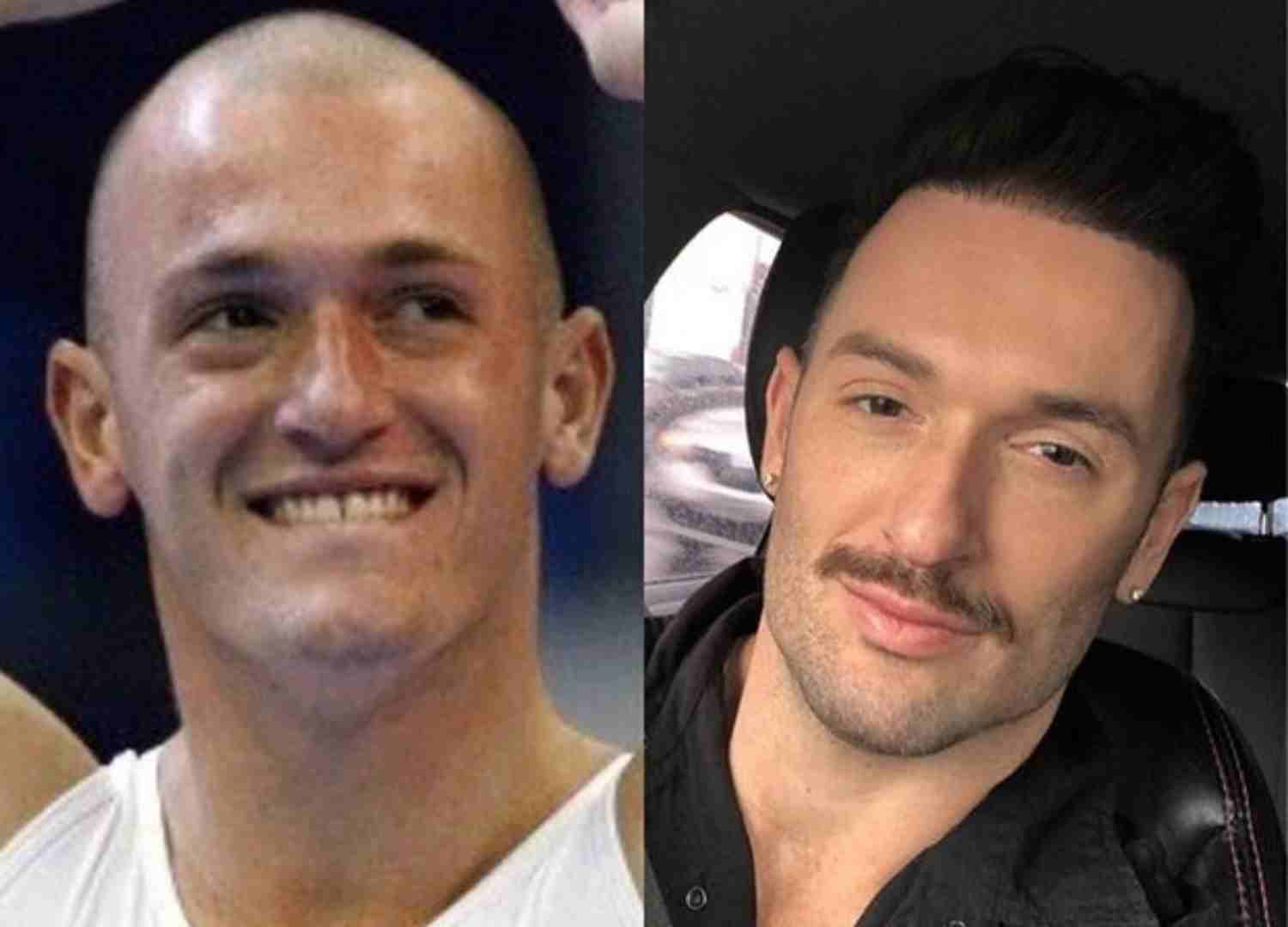 harmonizacao famosos (7)