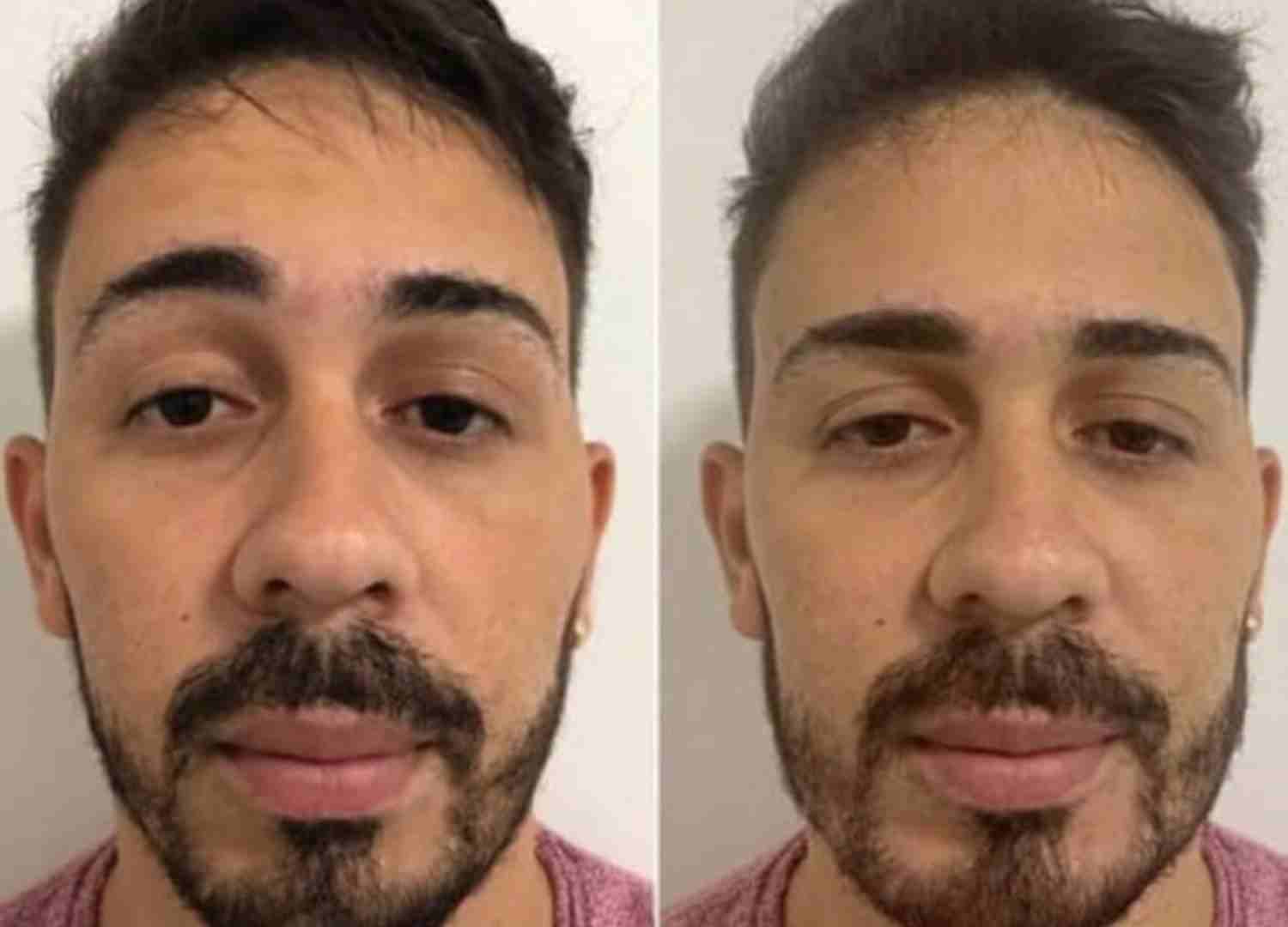 harmonizacao famosos (8)