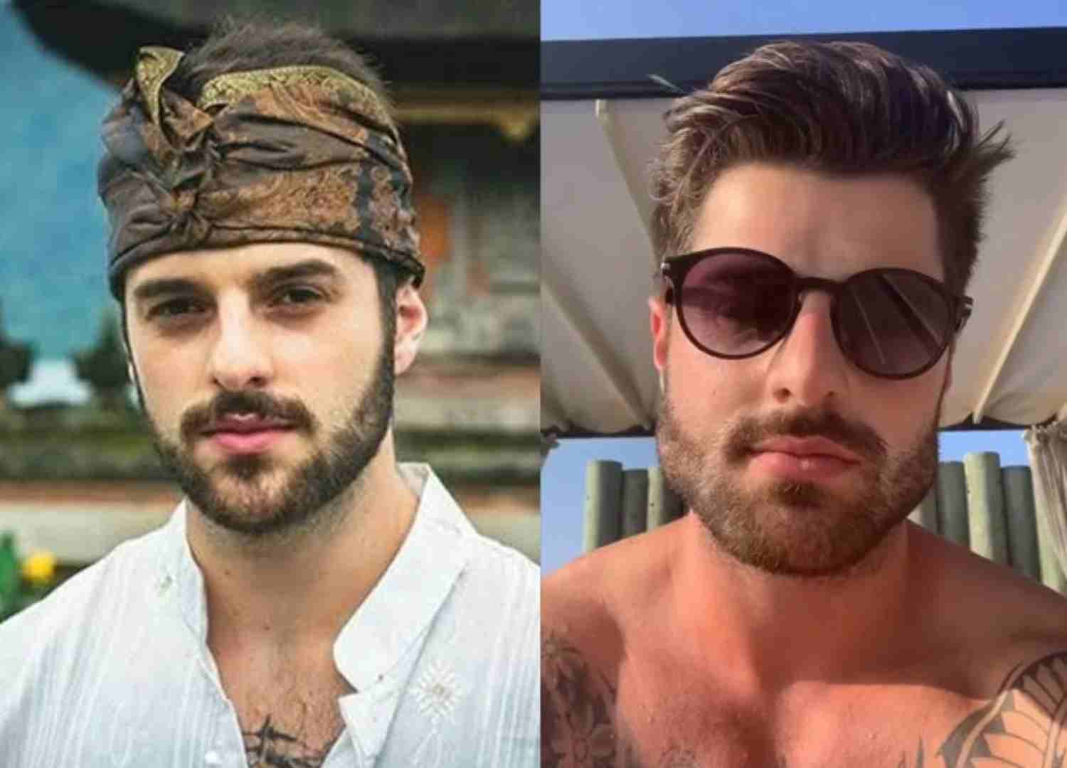 harmonizacao famosos (9)